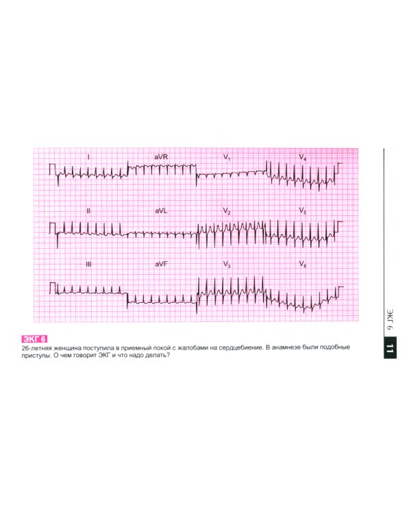 Атлас ЭКГ: 150 клинических ситуаций