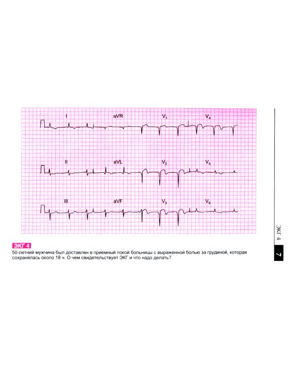 Атлас ЭКГ: 150 клинических ситуаций