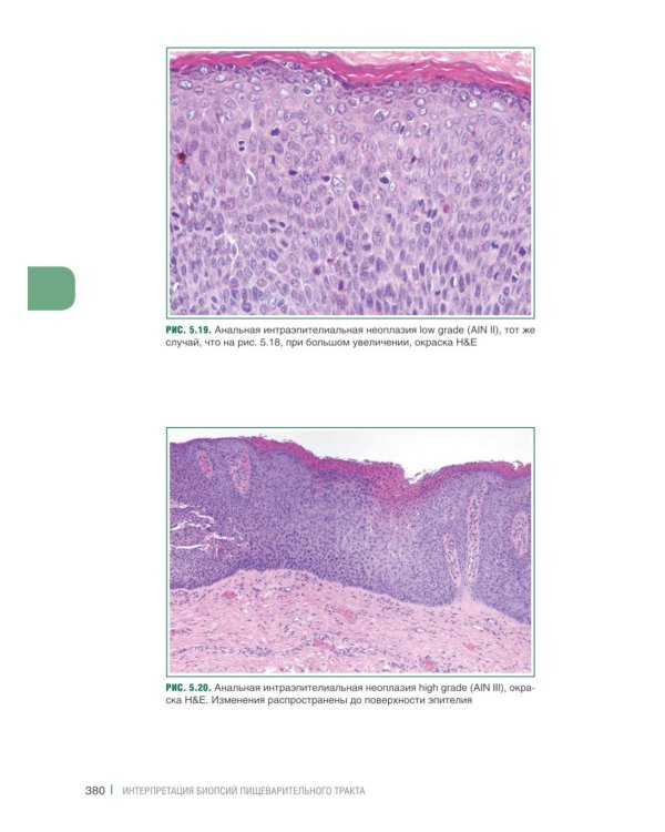 Интерпретация биопсий пищеварительного тракта. В 2 т. (комплект из 2 книг)