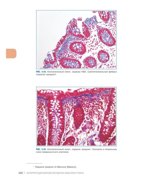 Интерпретация биопсий пищеварительного тракта. В 2 т. (комплект из 2 книг)