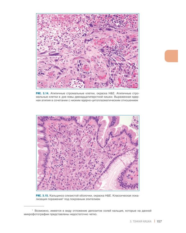 Интерпретация биопсий пищеварительного тракта. В 2 т. (комплект из 2 книг)