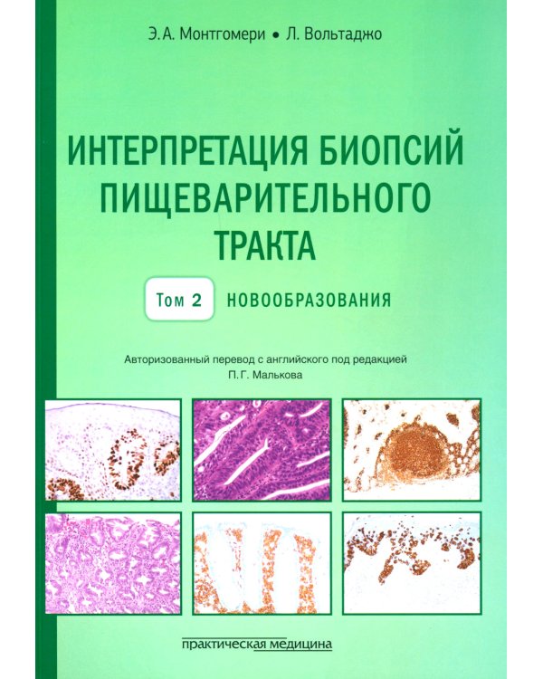 Интерпретация биопсий пищеварительного тракта. В 2 т. (комплект из 2 книг)