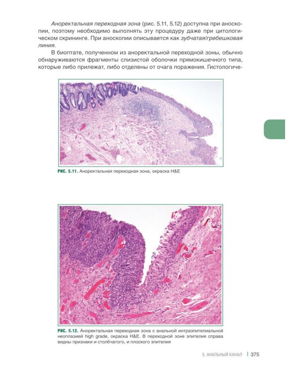 Интерпретация биопсий пищеварительного тракта. В 2 т. (комплект из 2 книг)