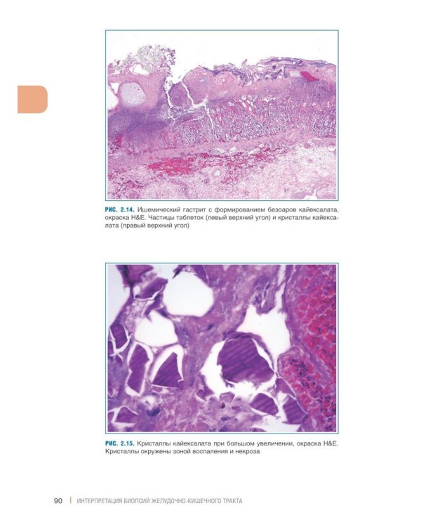 Интерпретация биопсий пищеварительного тракта. В 2 т. (комплект из 2 книг)
