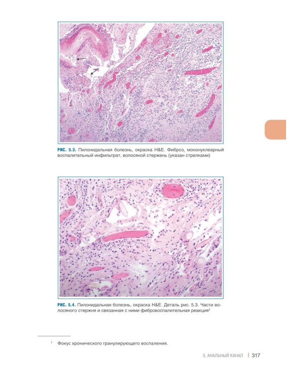Интерпретация биопсий пищеварительного тракта. В 2 т. (комплект из 2 книг)