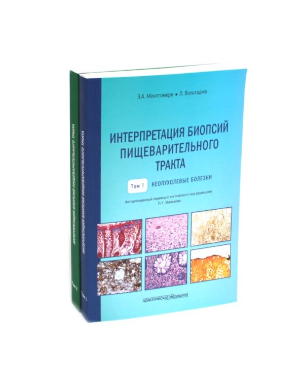 Интерпретация биопсий пищеварительного тракта. В 2 т. (комплект из 2 книг)