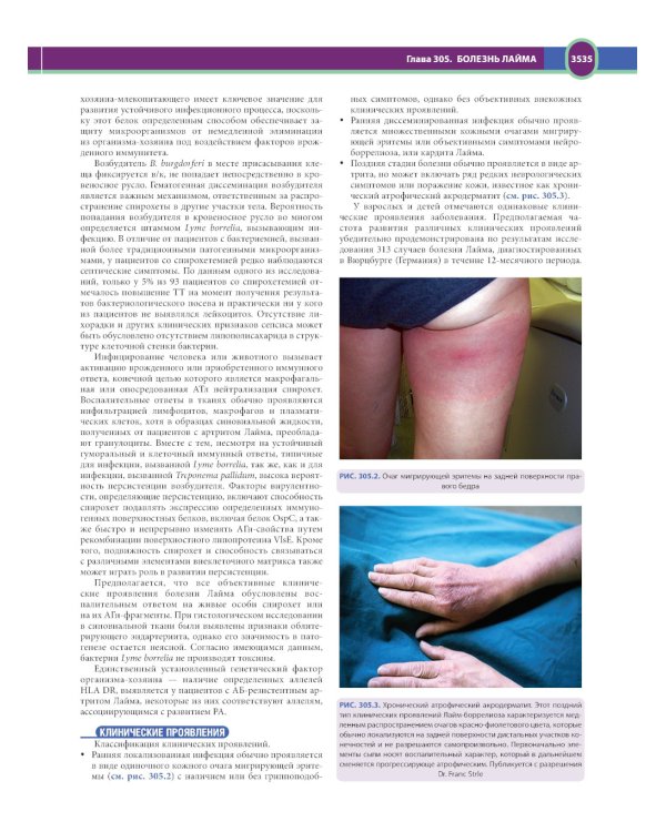 Терапия по Сесилю. В 4 т. Т. 4