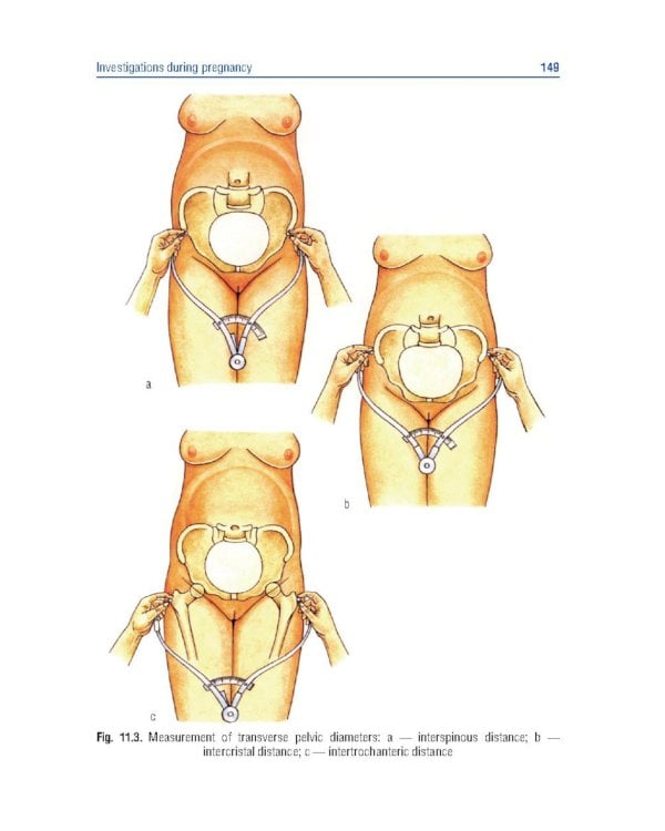 Obstetrics and gynecology. Textbook in 4 vol. Vol. 1. Physiological obstetrics