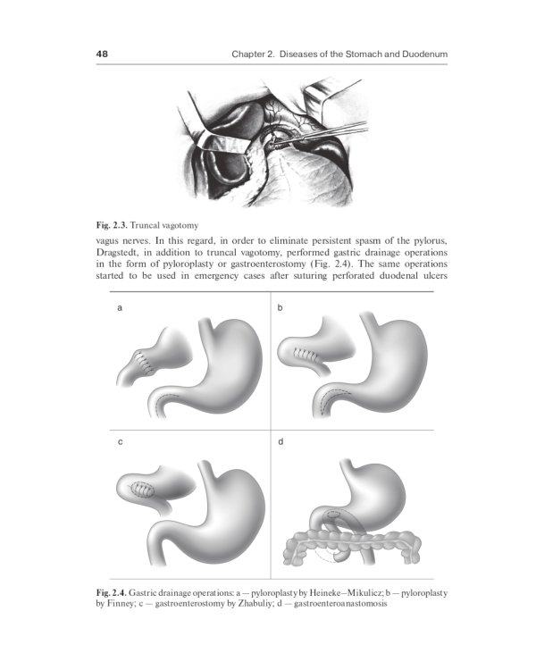 Surgical diseases : textbook. In 2 v. V. 2: на англ.яз