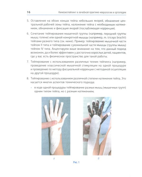 Кинезиотейпинг в лечебной практике неврологии и ортопедии