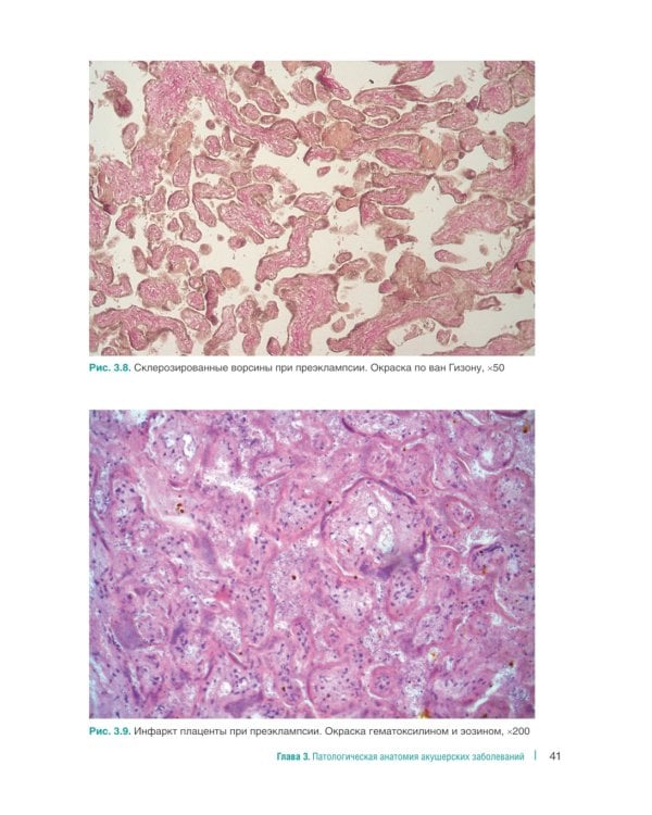 Справочник гинеколога-эндокринолога + Патологическая анатомия акушерских заболеваний (комплект из 2 книг)