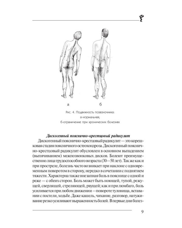Боль в спине и пояснице