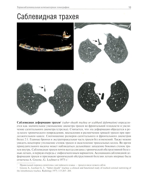 Торакоабдоминальная компьютерная томография. Образы и симптомы