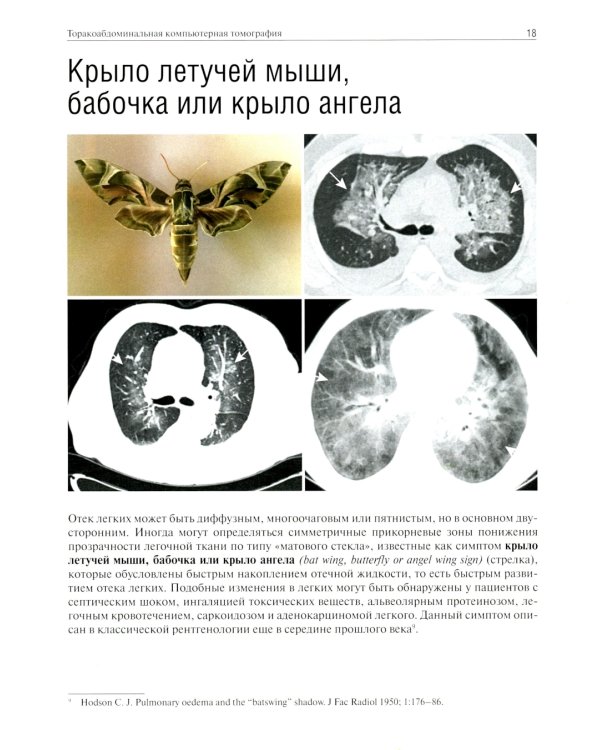 Торакоабдоминальная компьютерная томография. Образы и симптомы