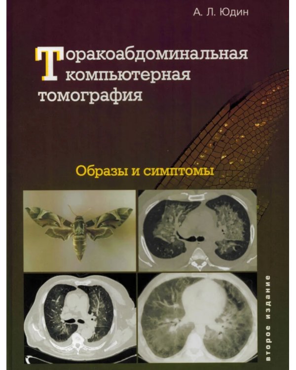 Торакоабдоминальная компьютерная томография. Образы и симптомы