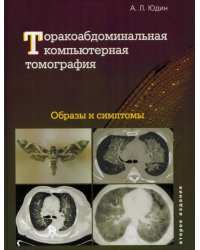 Торакоабдоминальная компьютерная томография. Образы и симптомы