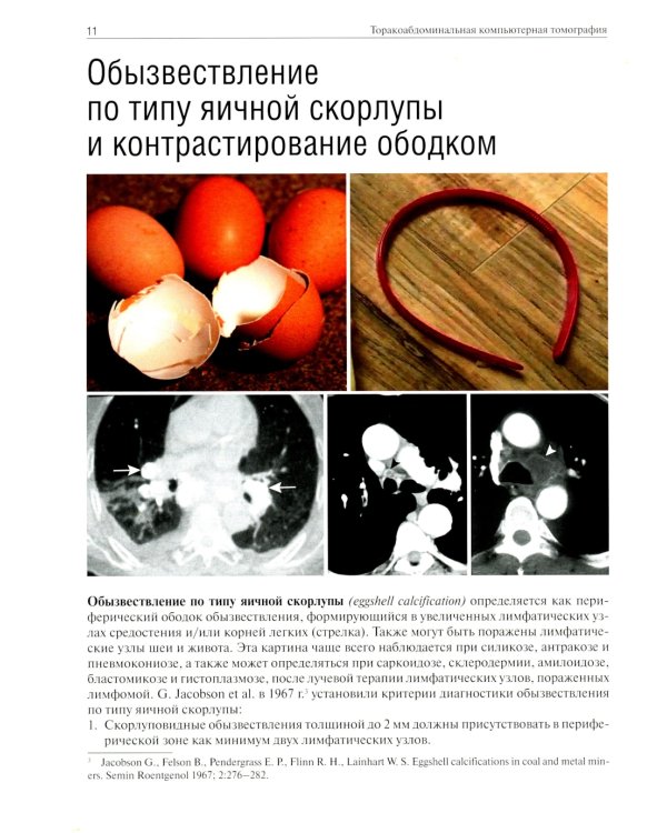 Торакоабдоминальная компьютерная томография. Образы и симптомы