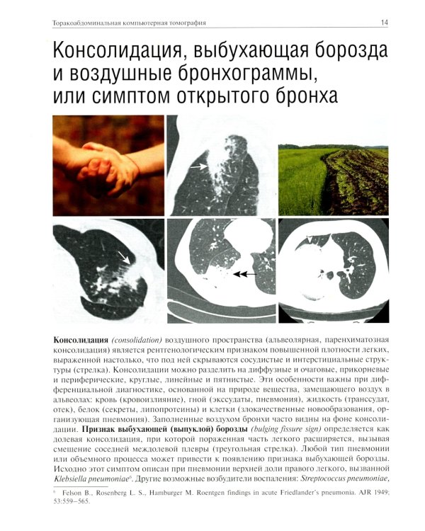 Торакоабдоминальная компьютерная томография. Образы и симптомы