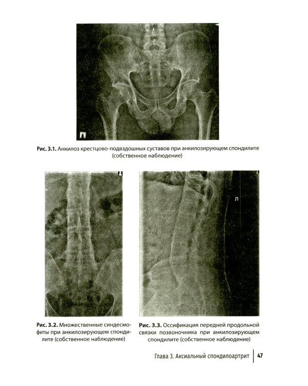 Боль в спине как междисциплинарная проблема: руководство для врачей