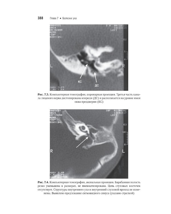 Оториноларингология: национальное руководство. Краткое издание. 2-е изд., перераб. и доп
