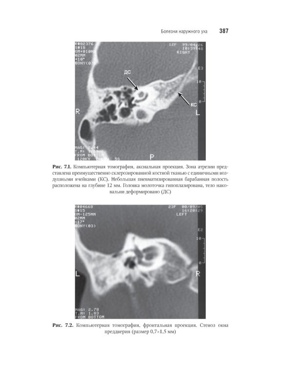 Оториноларингология: национальное руководство. Краткое издание. 2-е изд., перераб. и доп