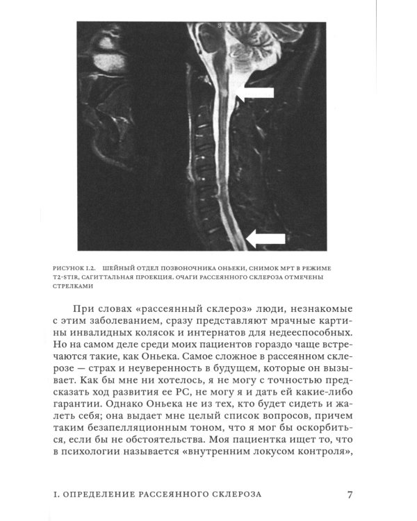 Поговорим о рассеянном склерозе: Семь шагов к преодолению болезни