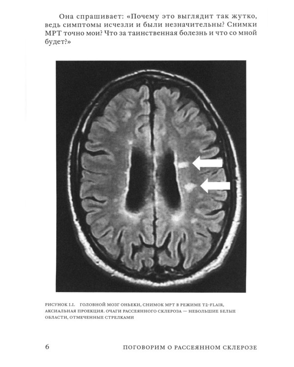 Поговорим о рассеянном склерозе: Семь шагов к преодолению болезни