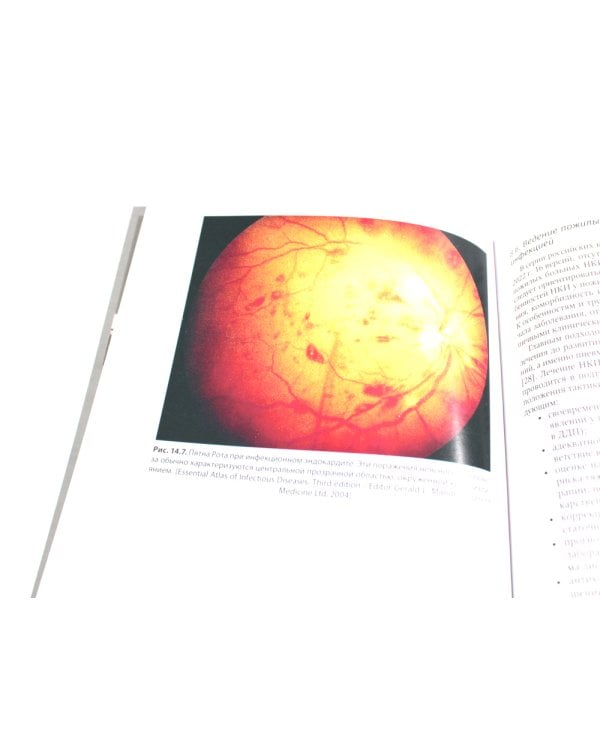 Пожилой пациент и инфекция: руководство для врачей. 2-е изд., перераб. и доп