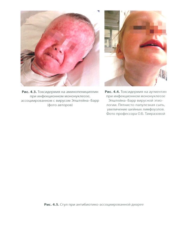 Антимикробная терапия инфекционных болезней у детей: руководство для врачей