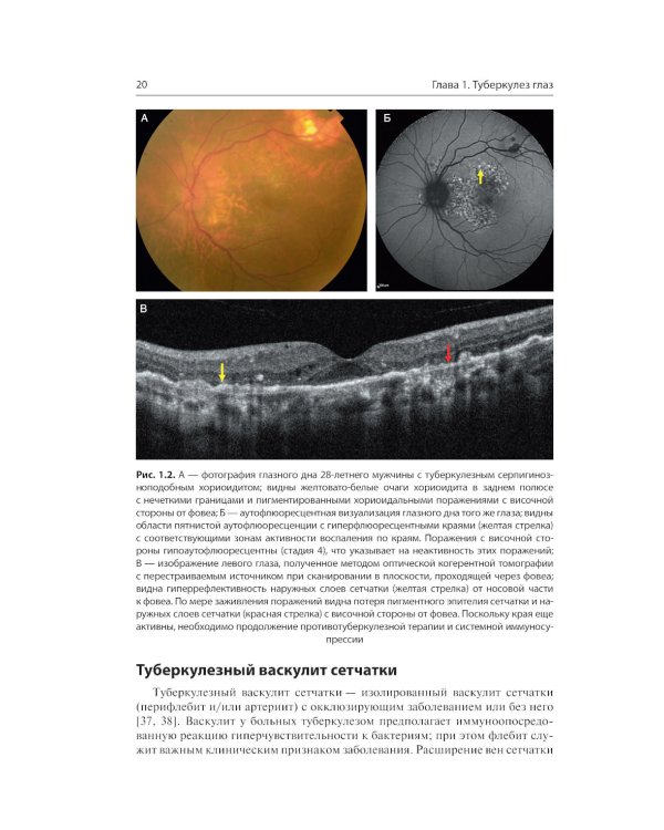 Инфекции глаз