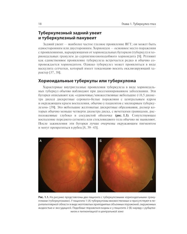 Инфекции глаз