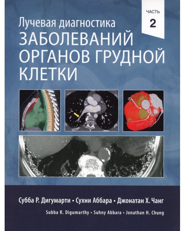 Лучевая диагностика заболеваний органов грудной клетки. В 2 ч. (комплект из 2-х книг)