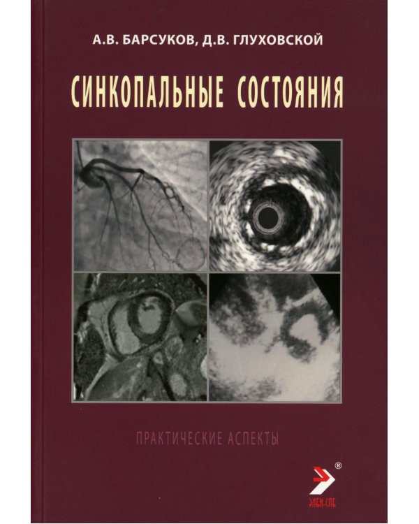 Синкопальные состояния: практические аспекты