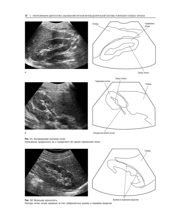 Практическая ультразвуковая диагностика: Руководство для врачей: В 5 т. Т. 2. Ультразвуковая диагностика заболеваний органов мочевыделительной системы