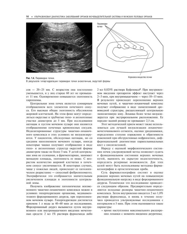 Практическая ультразвуковая диагностика: Руководство для врачей: В 5 т. Т. 2. Ультразвуковая диагностика заболеваний органов мочевыделительной системы