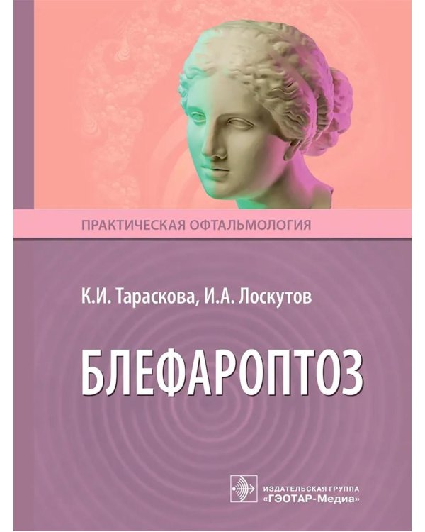 Блефароптоз