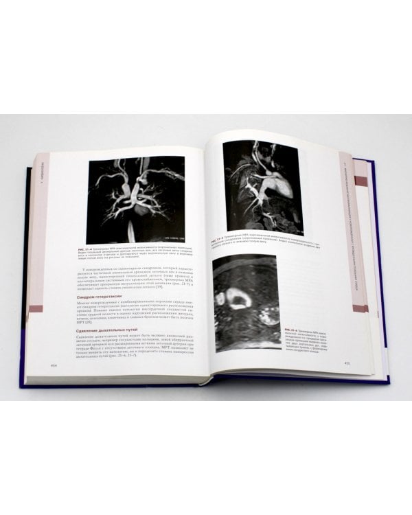 Гемодинамика и кардиология