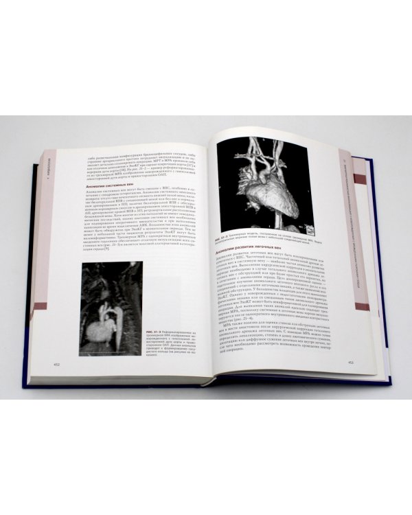 Гемодинамика и кардиология