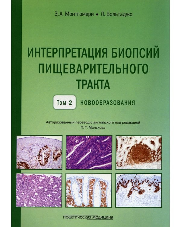 Интерпретация биопсий пищеварительного тракта. Т. 2: Новообразования