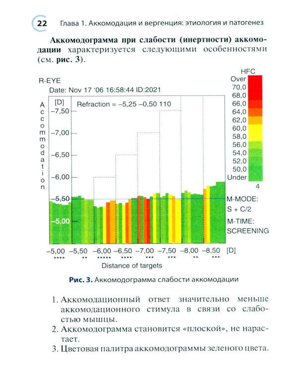 Нарушения аккомодации и вергенции: руководство для врачей