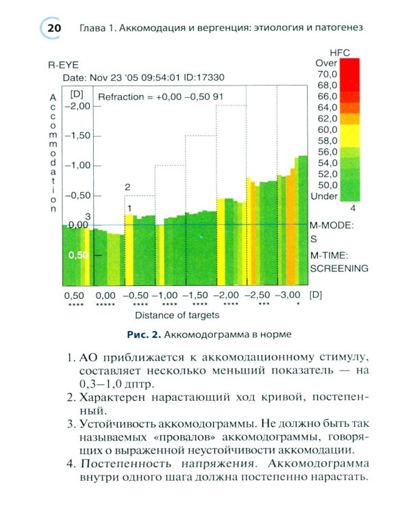 Нарушения аккомодации и вергенции: руководство для врачей