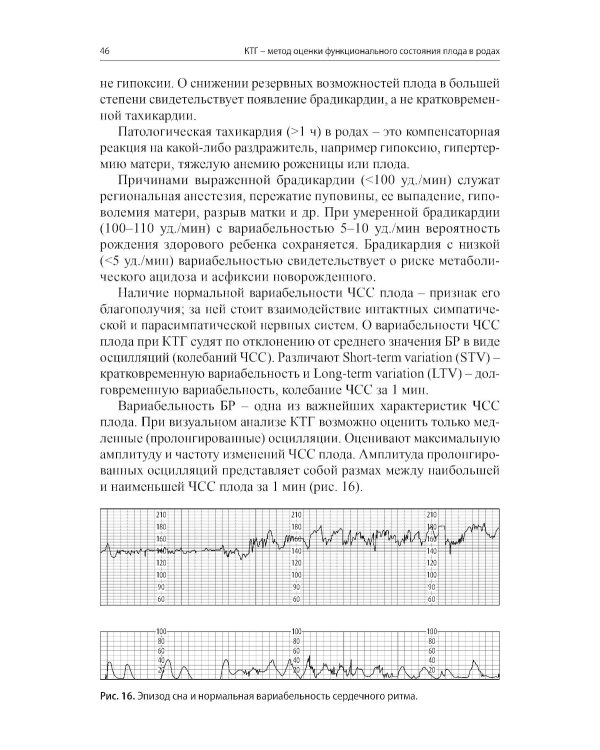 Кардиотокография - метод оценки функционального состояния плода во время беременности: Учебное пособие. 2-е изд