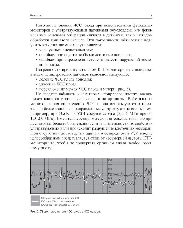 Кардиотокография - метод оценки функционального состояния плода во время беременности: Учебное пособие. 2-е изд