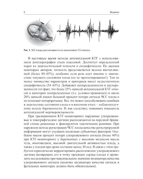 Кардиотокография - метод оценки функционального состояния плода во время беременности: Учебное пособие. 2-е изд