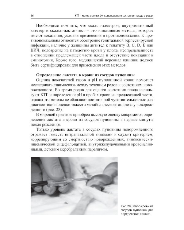 Кардиотокография - метод оценки функционального состояния плода во время беременности: Учебное пособие. 2-е изд