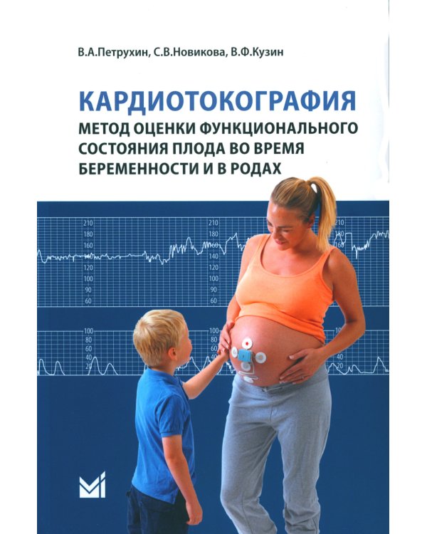 Кардиотокография - метод оценки функционального состояния плода во время беременности: Учебное пособие. 2-е изд