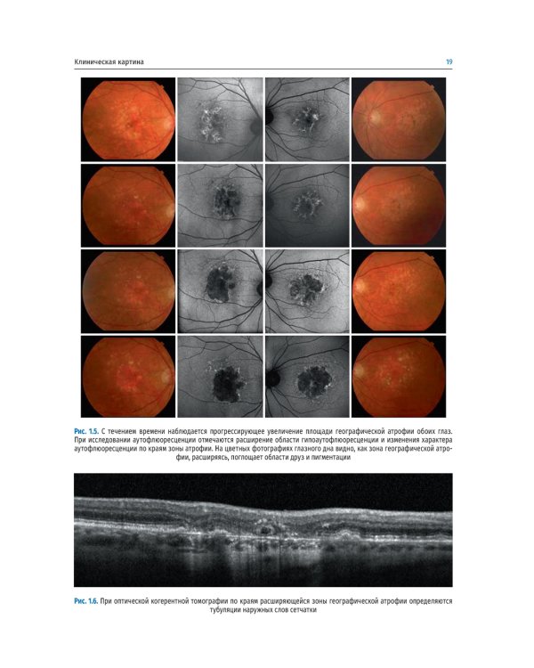 Заболевания макулярной области. Руководство