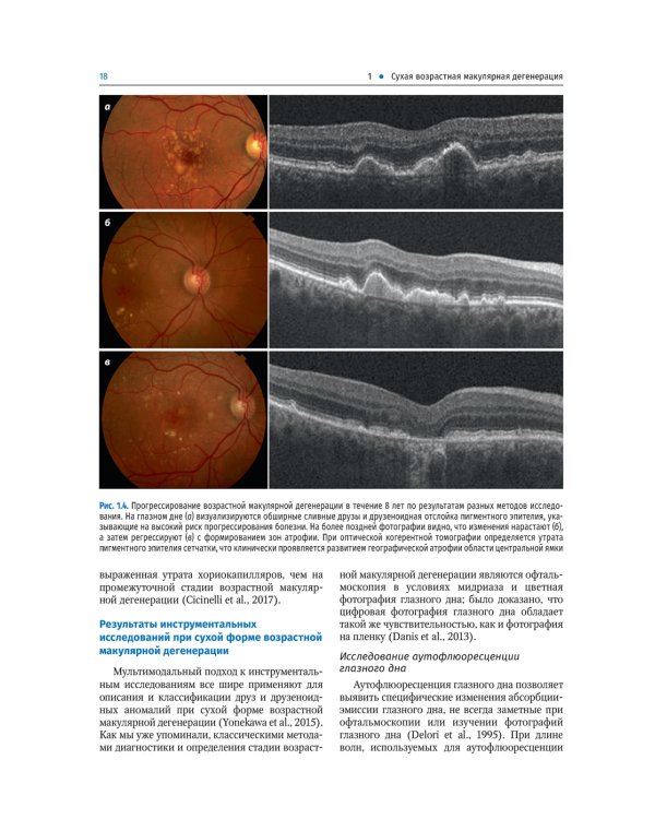 Заболевания макулярной области. Руководство