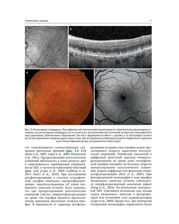 Заболевания макулярной области. Руководство