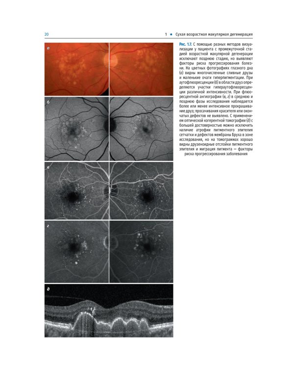 Заболевания макулярной области. Руководство